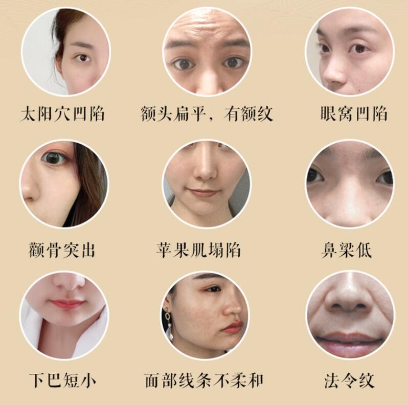宫廷古方:12节徒手小脸塑颜术-渡漳网